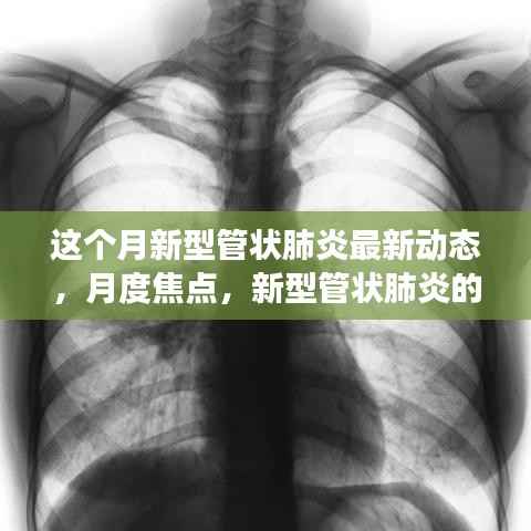 本月新型管状肺炎最新动态及月度焦点,动态更新与影响洞察