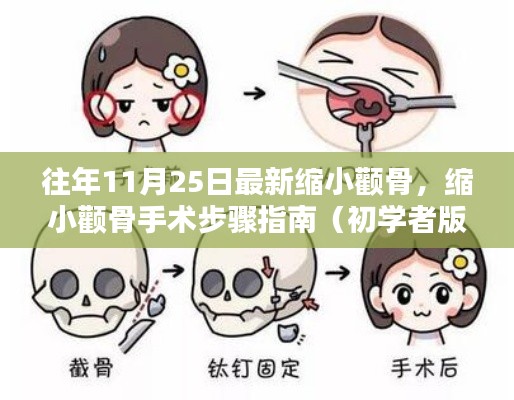 初学者指南,缩小颧骨手术步骤详解,历年经验总结助你轻松应对手术挑战