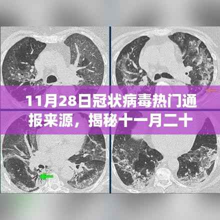 揭秘,11月28日冠状病毒最新通报背景、进展与影响全解析